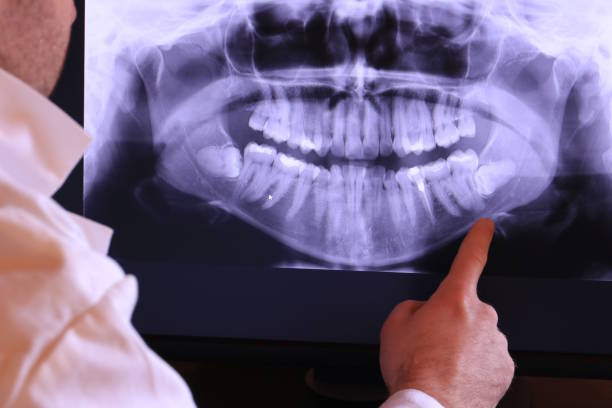 Best Urgent Care for Lost Fillings or Crowns in Lyons, GA